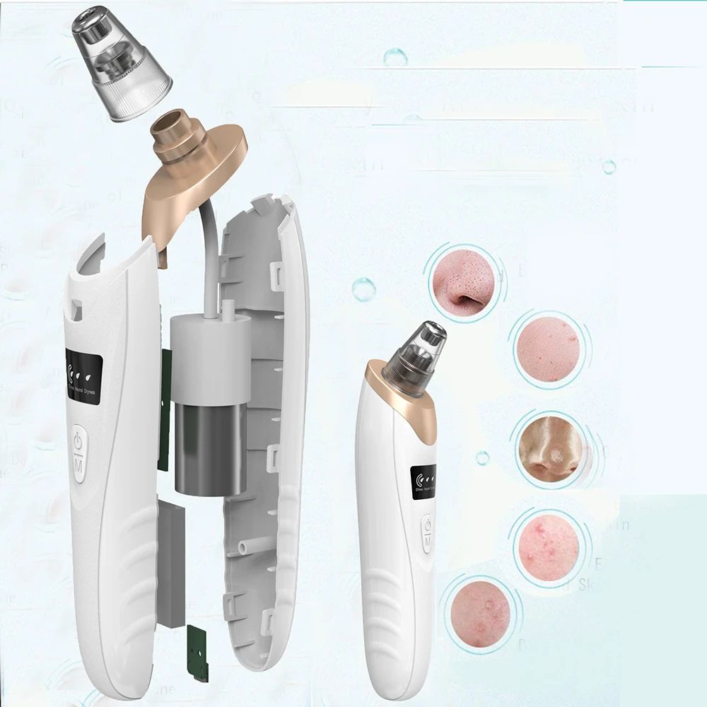 Rechargeable Blackhead Remover Vacuum | Pore Cleaner & Acne Suction Tool | ALL BAZAR