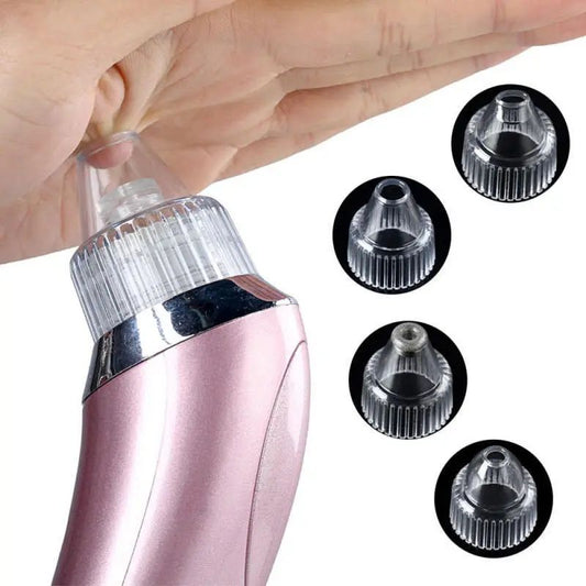 Rechargeable Blackhead Remover Vacuum | Pore Cleaner & Acne Suction Tool | ALL BAZAR