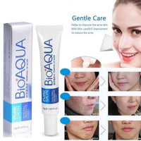 Bioaqua Acne Removal Cream 30g – Anti-Scar, Anti-Wrinkle & Skin Repair | ALL BAZAR