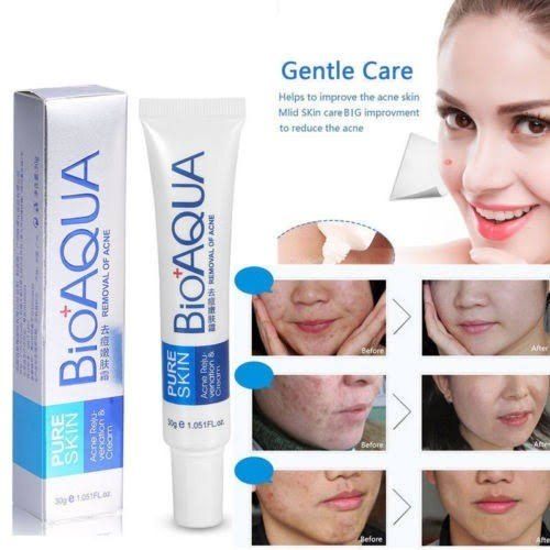 Bioaqua Acne Removal Cream 30g – Anti-Scar, Anti-Wrinkle & Skin Repair | ALL BAZAR