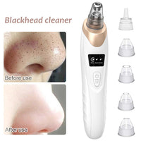Rechargeable Blackhead Remover Vacuum | Pore Cleaner & Acne Suction Tool | ALL BAZAR